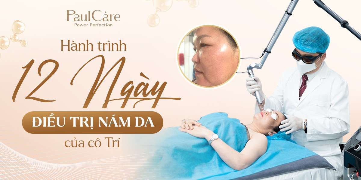 truoc_va_sau_dieu_tri_nam_paulcare_co_tri_03