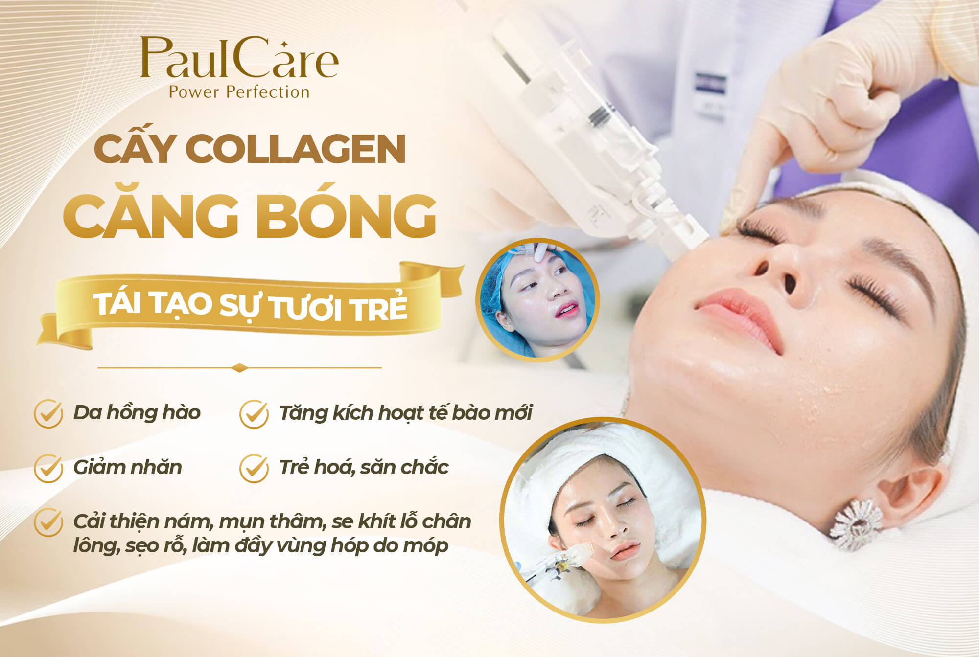 uu_diem_cua_cay_collagen_tuoi_tham_my_vien_paulcare