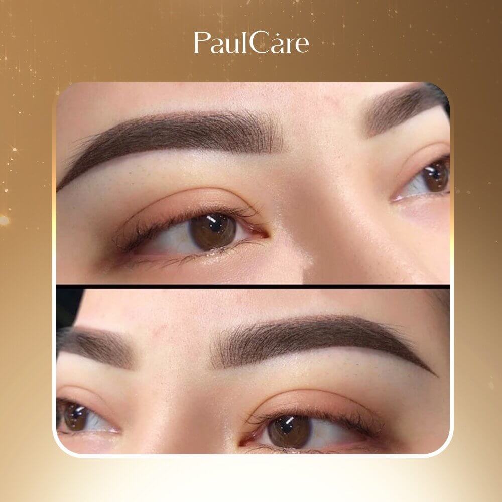 phun_may_ombre_tham_my_vien_paulcare_5