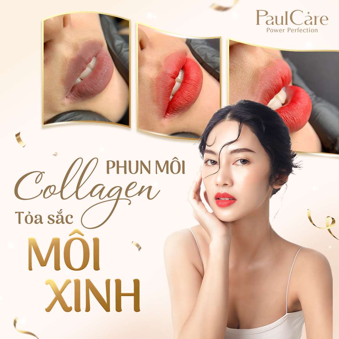 Dich_vu_phun_moi_collagen_tham_my_vien_paulcare